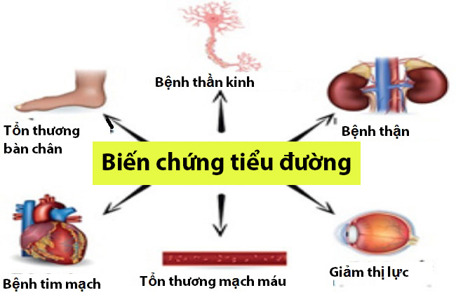 Nên ăn uống như thế nào để tránh biến chứng tiểu đường?